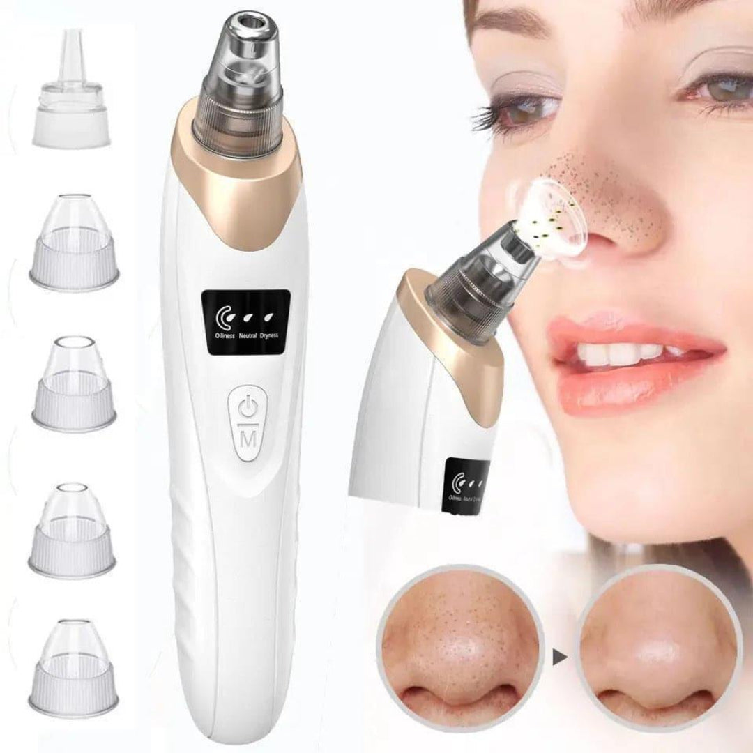 Electric blackhead remover in white and gold
