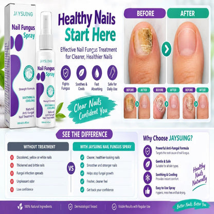 Medinail Nail Fungus Spray | NOOREL.SHOP