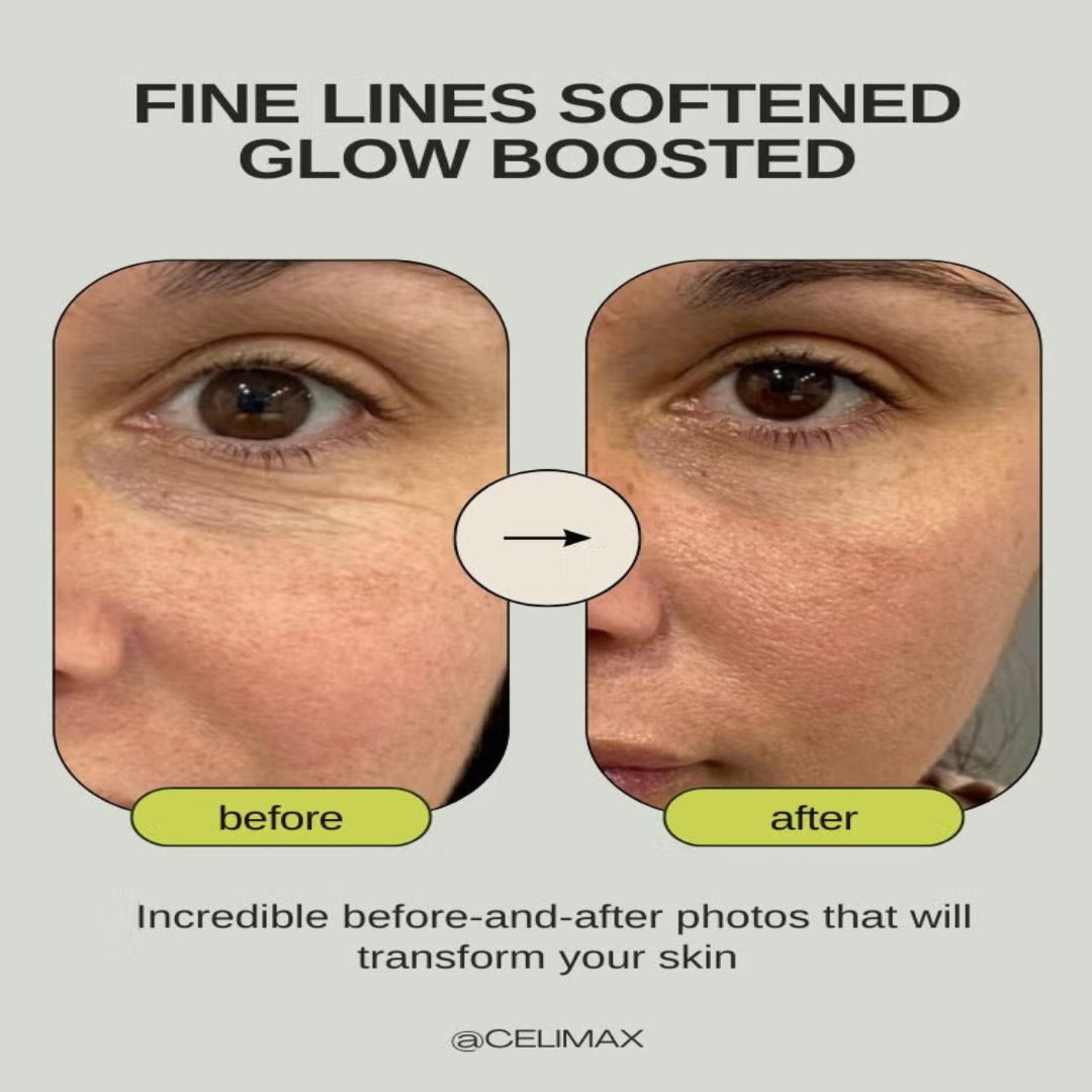 Retinal Shot Tightening Booster Cream packaging, if shown